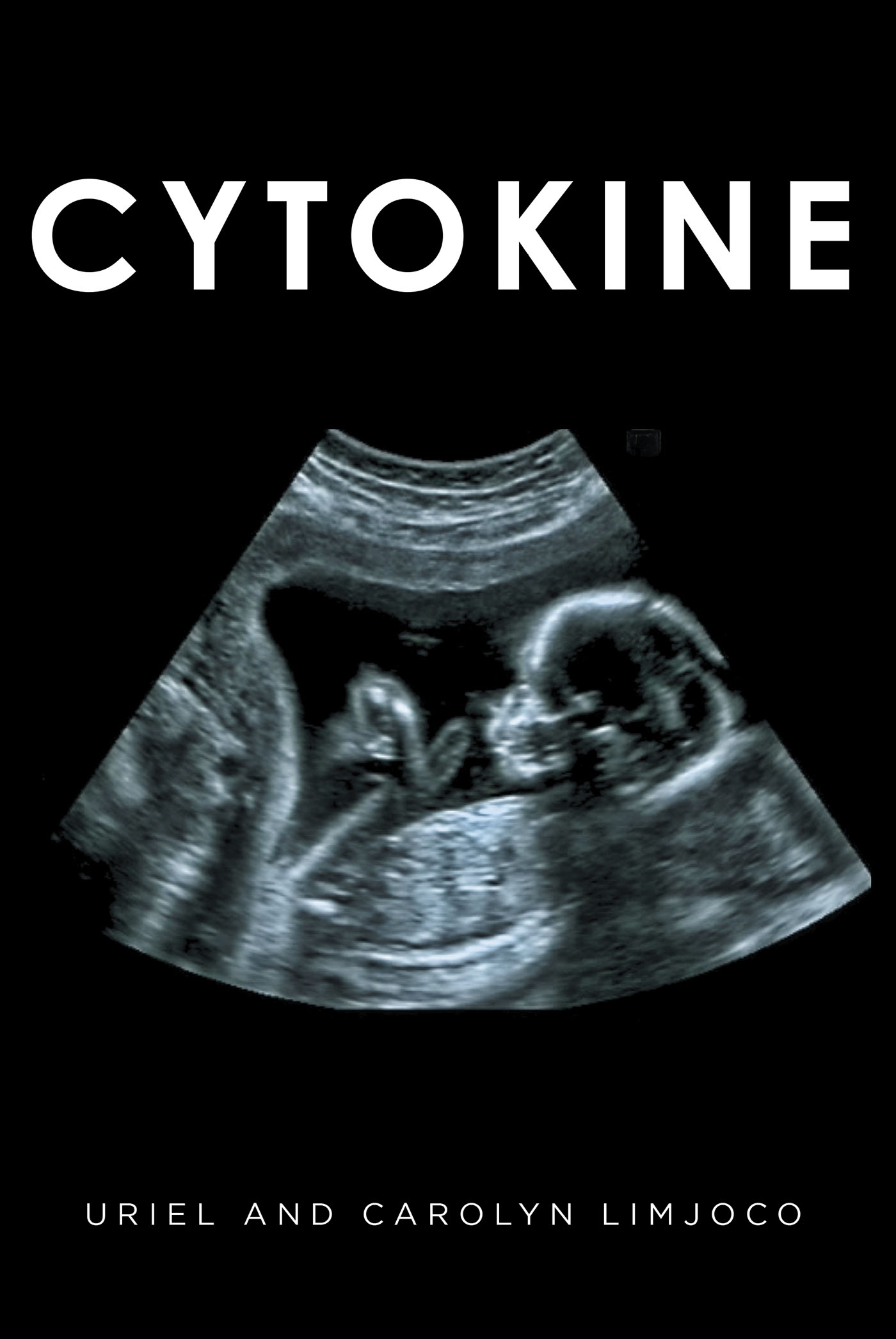 Cytokine Cover Image