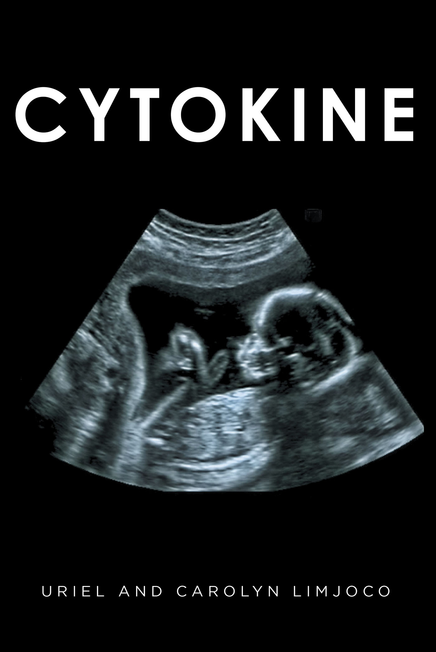 Cytokine Cover Image