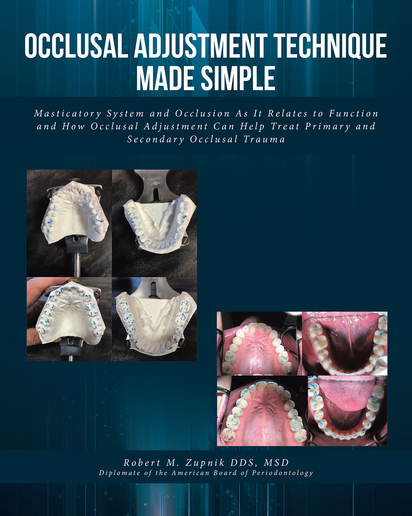 Occlusal Adjustment Technique Made Simple Cover Image